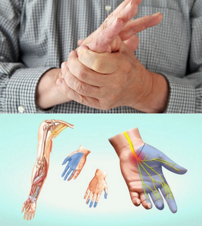 Причины онемения рук и ног